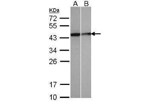 WB Image Sample(30 μg of whole cell lysate) A:A431, B:MOLT4, 12% SDS PAGE antibody diluted at 1:500 (SEPHS1 anticorps)