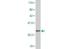 Western Blot detection against Immunogen (35. (MEOX1 anticorps  (AA 82-170))