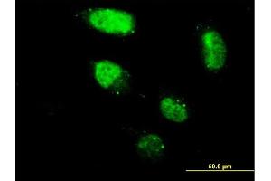 Immunofluorescence of monoclonal antibody to ZNF213 on HeLa cell. (ZNF213 anticorps  (AA 133-242))