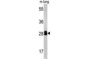 Western blot analysis of PSME2 antibody (C-term) in mouse lung tissue lysates (35ug/lane).