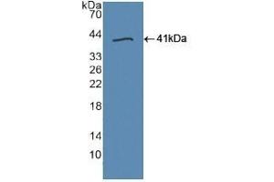 Detection of Recombinant TLR9, Human using Polyclonal Antibody to Toll Like Receptor 9 (TLR9)