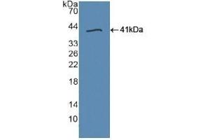 Detection of Recombinant TLR9, Human using Polyclonal Antibody to Toll Like Receptor 9 (TLR9) (TLR9 anticorps  (AA 28-362))