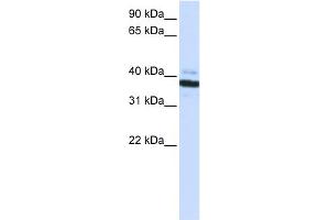 WB Suggested Anti-OAS1 Antibody Titration:  0. (OAS1 anticorps  (C-Term))