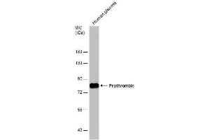 WB Image Human tissue extract (30 μg) was separated by 7.
