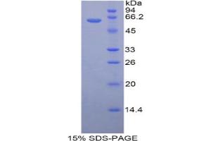 SDS-PAGE analysis of Mouse HSD17b12 Protein. (HSD17B12 Protéine)
