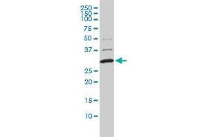 COMT monoclonal antibody (M01), clone 1G4-1A1 Western Blot analysis of COMT expression in A-431 . (COMT anticorps  (AA 1-182))