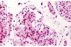 Human Testis: Formalin-Fixed, Paraffin-Embedded (FFPE) (SUPT16H anticorps  (AA 321-640))