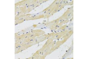 Immunohistochemistry of paraffin-embedded rat heart using TRAP1 Antibody (ABIN5971463) at dilution of 1/100 (40x lens). (TRAP1 anticorps)