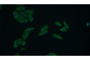 Detection of PKM2 in Human MCF7 cell using Polyclonal Antibody to Pyruvate kinase isozymes M2 (PKM2)