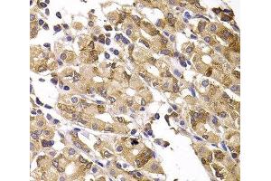 Immunohistochemistry of paraffin-embedded Human gastric damage using ASMTL Polyclonal Antibody at dilution of 1:100 (40x lens). (ASMTL anticorps)