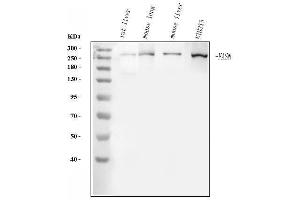 Western blot analysis of FASN using anti-FASN antibody (ABIN3044520). (Fatty Acid Synthase anticorps  (AA 1-226))