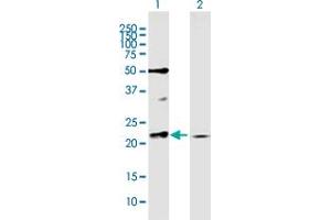 Western Blot analysis of RAB11A expression in transfected 293T cell line by RAB11A MaxPab polyclonal antibody. (RAB11A anticorps  (AA 1-216))