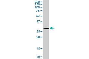 HSD17B8 MaxPab polyclonal antibody. (HSD17B8 anticorps  (AA 1-261))