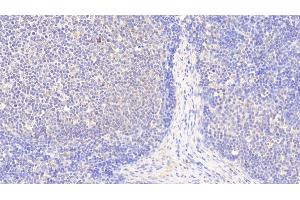Detection of S100Z in Human Lymph node Tissue using Polyclonal Antibody to S100 Calcium Binding Protein Z (S100Z) (S100Z anticorps  (AA 1-99))