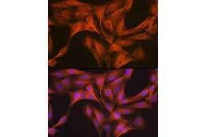Immunofluorescence analysis of C6 cells using CLOCK Rabbit mAb (ABIN7266414) at dilution of 1:100 (40x lens). (CLOCK anticorps)