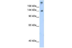 WB Suggested Anti-SF3B1 Antibody Titration:  1. (SF3B1 anticorps  (N-Term))