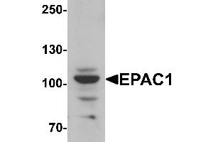 Western blot analysis of EPAC1 in rat skeletal muscle tissue lysate with EPAC1 antibody at 1 µg/mL. (RAPGEF3 anticorps  (N-Term))