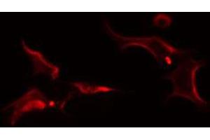 ABIN6274256 staining Hela cells by IF/ICC.