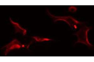 ABIN6274256 staining Hela cells by IF/ICC. (FRK anticorps  (Internal Region))