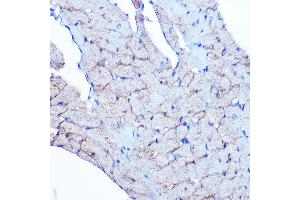 Immunohistochemistry of paraffin-embedded rat heart using Flotillin 1 Rabbit mAb (ABIN3017206, ABIN3017207, ABIN1680028 and ABIN1680029) at dilution of 1:100 (40x lens). (Flotillin 1 anticorps)