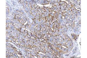 IHC analysis of ENPP1/PC1 using anti-ENPP1/PC1 antibody (ABIN7601410). (ENPP1 anticorps  (AA 347-789))