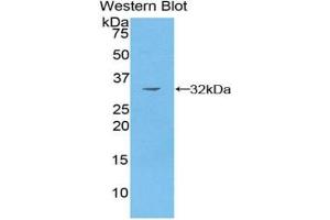Detection of Recombinant PAK4, Human using Polyclonal Antibody to p21 Protein Activated Kinase 4 (PAK4) (PAK4 anticorps  (AA 299-542))