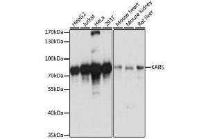 Western blot analysis of extracts of various cell lines, using KARS antibody. (KARS anticorps  (AA 298-597))