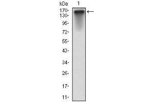 Western blot analysis using MSH6 mAb against human MSH6 (AA: 217-395) recombinant protein.