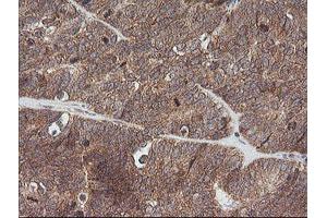 Image no. 6 for anti-V-Ets Erythroblastosis Virus E26 Oncogene Homolog 2 (ETS2) (AA 90-349) antibody (ABIN1491702) (ETS2 anticorps  (AA 90-349))