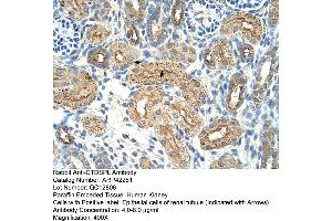 Rabbit Anti-CTDSPL Antibody  Paraffin Embedded Tissue: Human Kidney Cellular Data: Epithelial cells of renal tubule Antibody Concentration: 4. (CTDSPL anticorps  (N-Term))