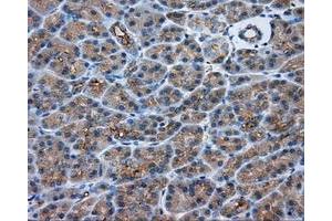 Immunohistochemical staining of paraffin-embedded Kidney tissue using anti-PRKAR2A mouse monoclonal antibody. (PRKAR2A anticorps)