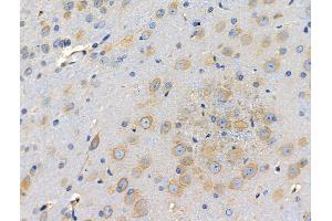 ABIN6257484 and ABIN6274780 at 1/100 staining Rat brain tissue by IHC-P. (RPL35 anticorps  (C-Term))