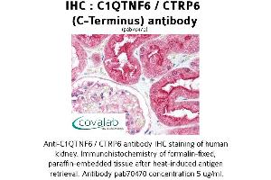 Image no. 2 for anti-Complement C1q Tumor Necrosis Factor-Related Protein 6 (C1QTNF6) antibody (ABIN1732486) (CTRP6 anticorps)