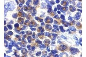 Immunohistochemistry of DAPK2 in mouse spleen cells with DAPK2 antibody at 2 μg/ml. (DAPK2 anticorps)