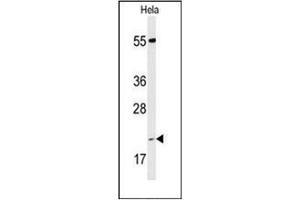 Western blot analysis of PPIC Antibody (Center) in Hela cell line lysates (35ug/lane). (PPIC anticorps  (Middle Region))