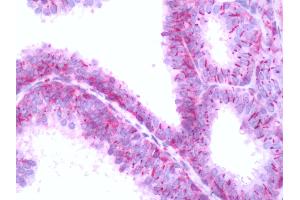 Human Seminal Vesicle: Formalin-Fixed, Paraffin-Embedded (FFPE)