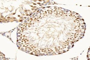 Immunohistochemistry analysis of paraffin-embedded rat testis using,SET (ABIN7075583) at dilution of 1: 10000