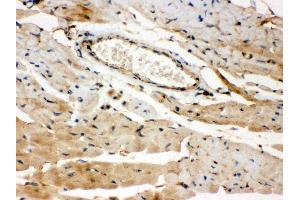 Anti- ROCK2 Picoband antibody,IHC(P) IHC(P): Mouse Cardiac Muscle Tissue (ROCK2 anticorps  (AA 652-923))