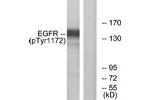 Western blot analysis of extracts from A431 cells treated with EGF 40 muM 10', using EGFR (Phospho-Tyr1172) Antibody. (EGFR anticorps  (pTyr1172))