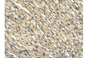 Rabbit Anti-WDR39 antibody         Paraffin Embedded Tissue:  Human Heart    cell Cellular Data:  cardiac cell    Antibody Concentration:  4.