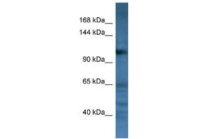 WB Suggested Anti-CD22 Antibody Titration: 0. (CD22 anticorps  (C-Term))