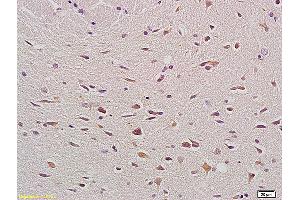 Formalin-fixed and paraffin embedded rat brain labeled with Anti- Bax Polyclonal Antibody, Unconjugated (ABIN725375) at 1:200, followed by conjugation to the secondary antibody and DAB staining. (BAX anticorps  (AA 84-175))