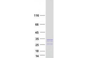 Validation with Western Blot