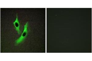 Immunofluorescence analysis of HeLa cells, using STEAP4 Antibody. (STEAP4 anticorps  (AA 201-250))