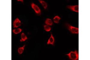 ABIN6266571 staining HT29 by IF/ICC.