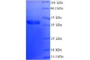 SDS-PAGE (SDS) image for BCL2-Like 1 (BCL2L1) (AA 1-209), (partial) protein (His-SUMO Tag) (ABIN5709127)