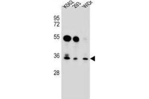Western Blotting (WB) image for anti-GLI Pathogenesis-Related 1 Like 2 (GLIPR1L2) antibody (ABIN2996840)
