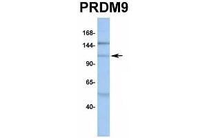 Host:  Rabbit  Target Name:  PRDM9  Sample Type:  MCF7  Antibody Dilution:  1. (PRDM9 anticorps  (Middle Region))