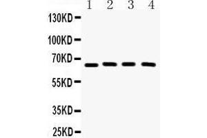 Western Blotting (WB) image for anti-Cryptochrome 2 (Photolyase-Like) (CRY2) (AA 171-200), (N-Term) antibody (ABIN3042760) (CRY2 anticorps  (N-Term))