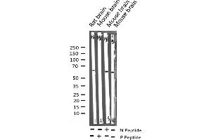 Western blot analysis of Phospho-Elk1 (Ser389) expression in various lysates